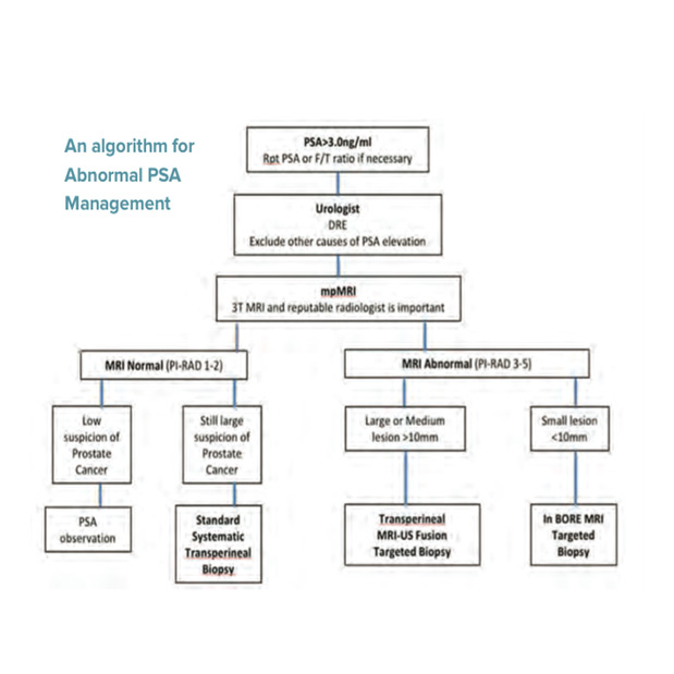 An algorithm for abnormal PSA management